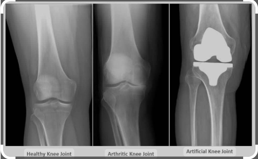 Ajinkyatara Multispeciality Hospital|Sadar Bazar,Satara